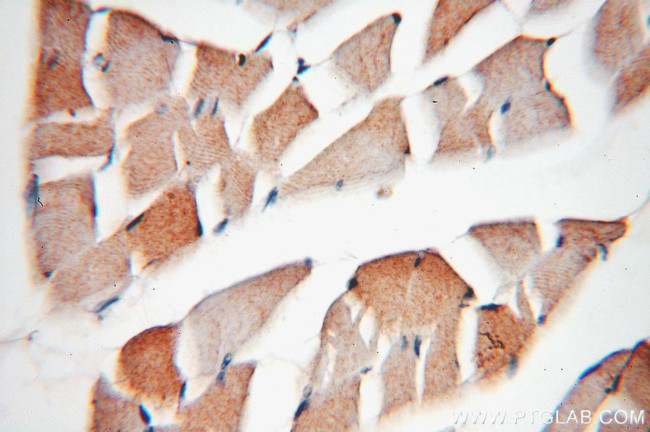 Phospholemman/FXYD1 Antibody in Immunohistochemistry (Paraffin) (IHC (P))