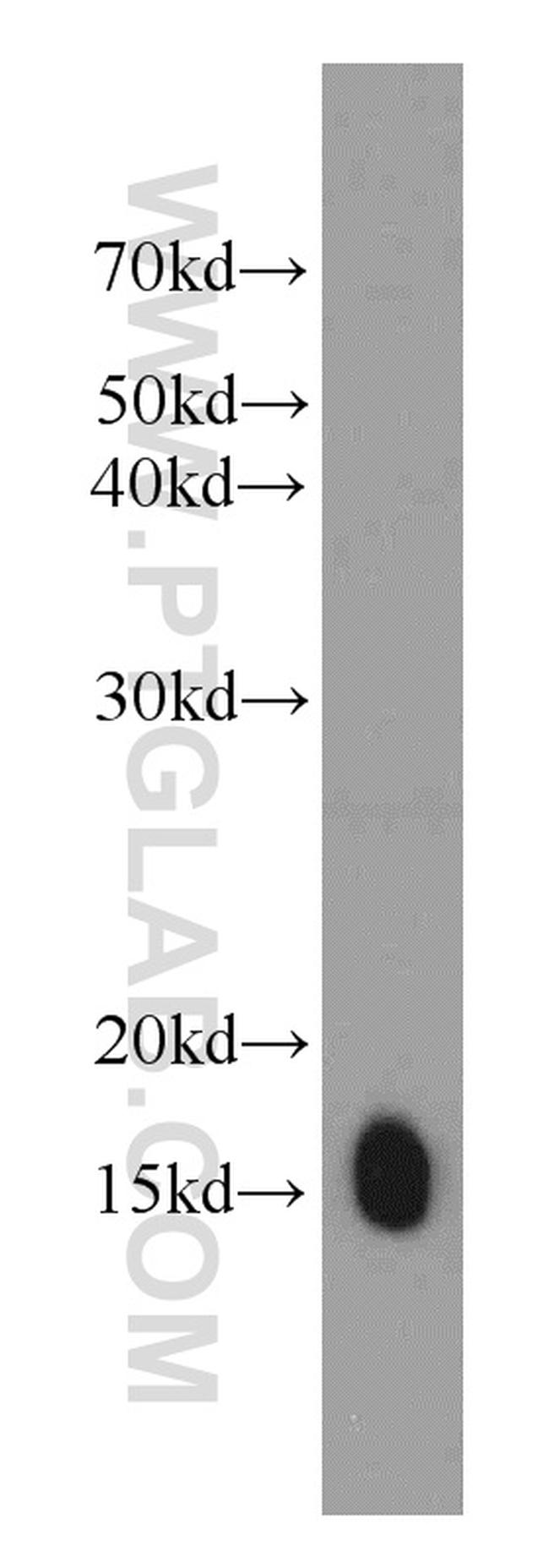 Phospholemman/FXYD1 Antibody in Western Blot (WB)