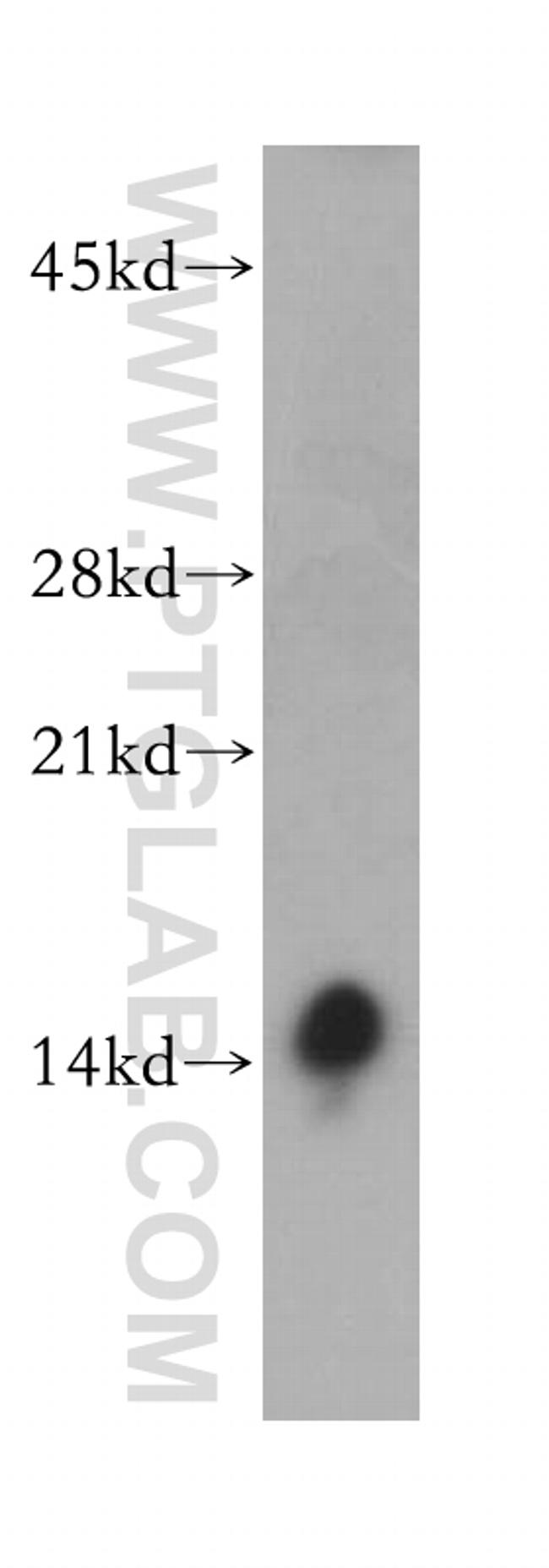 Phospholemman/FXYD1 Antibody in Western Blot (WB)