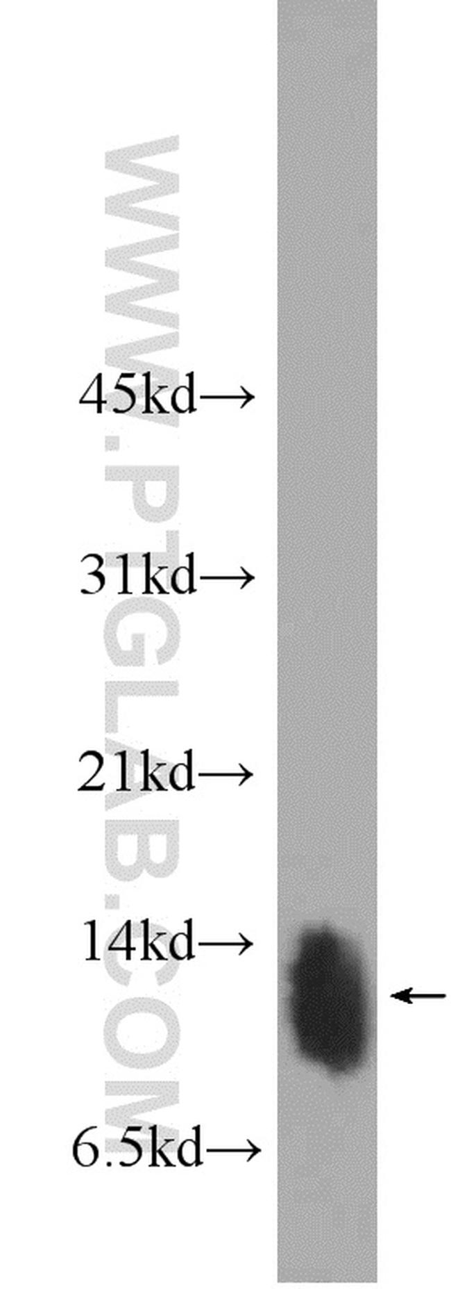 Phospholemman/FXYD1 Antibody in Western Blot (WB)