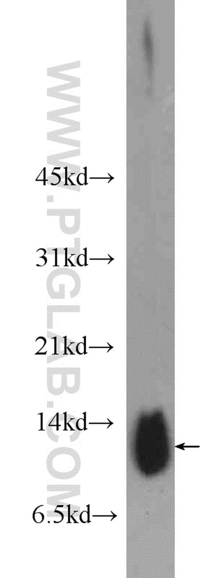 Phospholemman/FXYD1 Antibody in Western Blot (WB)