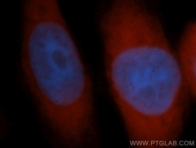 TTF2 Antibody in Immunocytochemistry (ICC/IF)