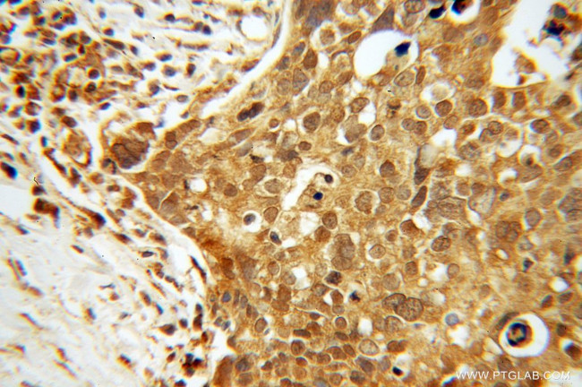 TTF2 Antibody in Immunohistochemistry (Paraffin) (IHC (P))