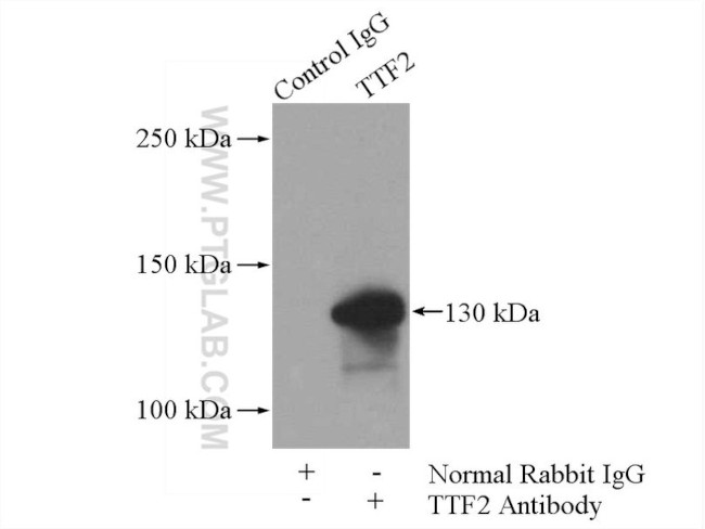 TTF2 Antibody in Immunoprecipitation (IP)