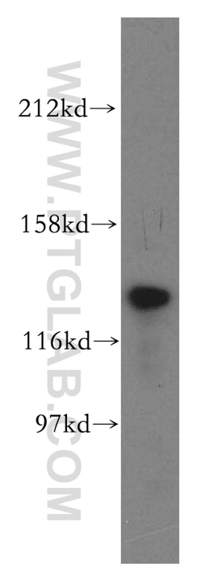 TTF2 Antibody in Western Blot (WB)