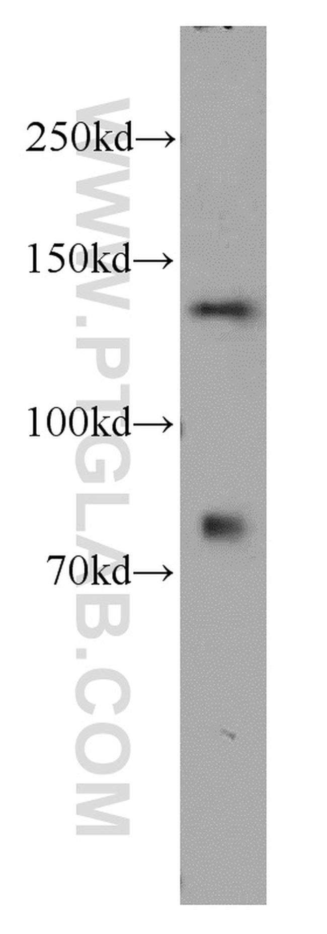 TTF2 Antibody in Western Blot (WB)