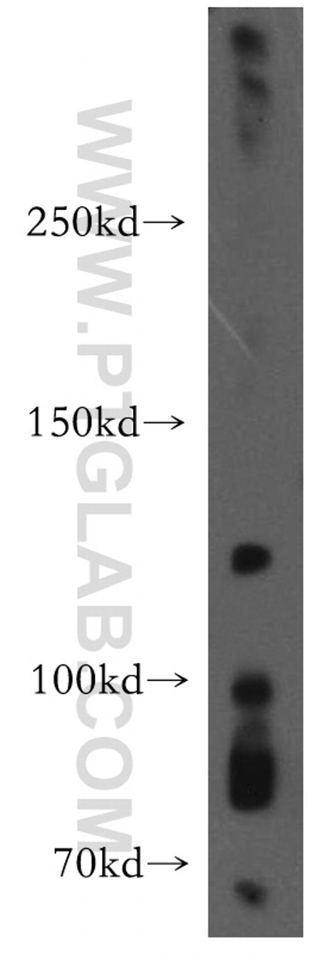 EPHA8 Antibody in Western Blot (WB)