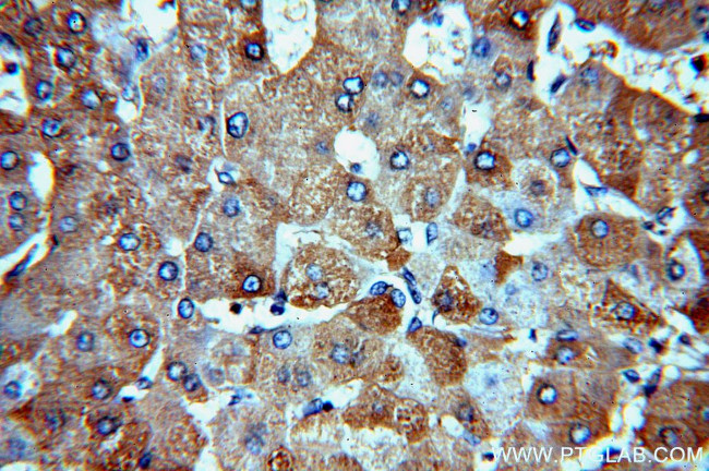 CBR4 Antibody in Immunohistochemistry (Paraffin) (IHC (P))