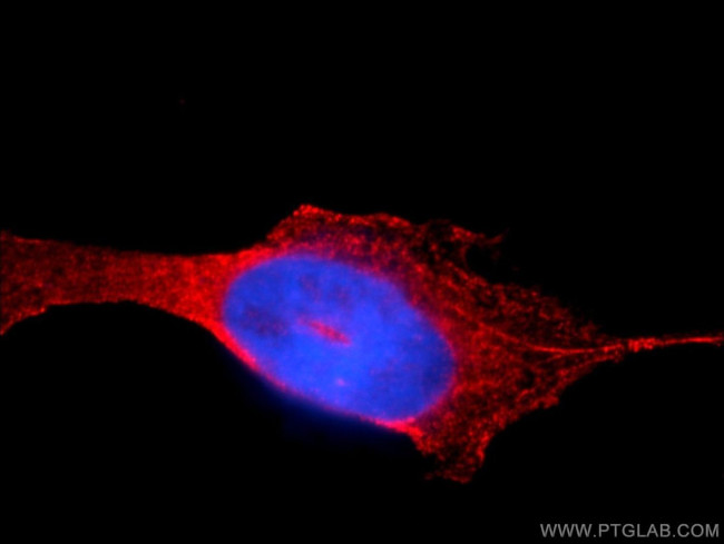 AUP1 Antibody in Immunocytochemistry (ICC/IF)