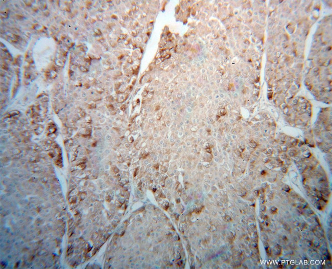 AUP1 Antibody in Immunohistochemistry (Paraffin) (IHC (P))