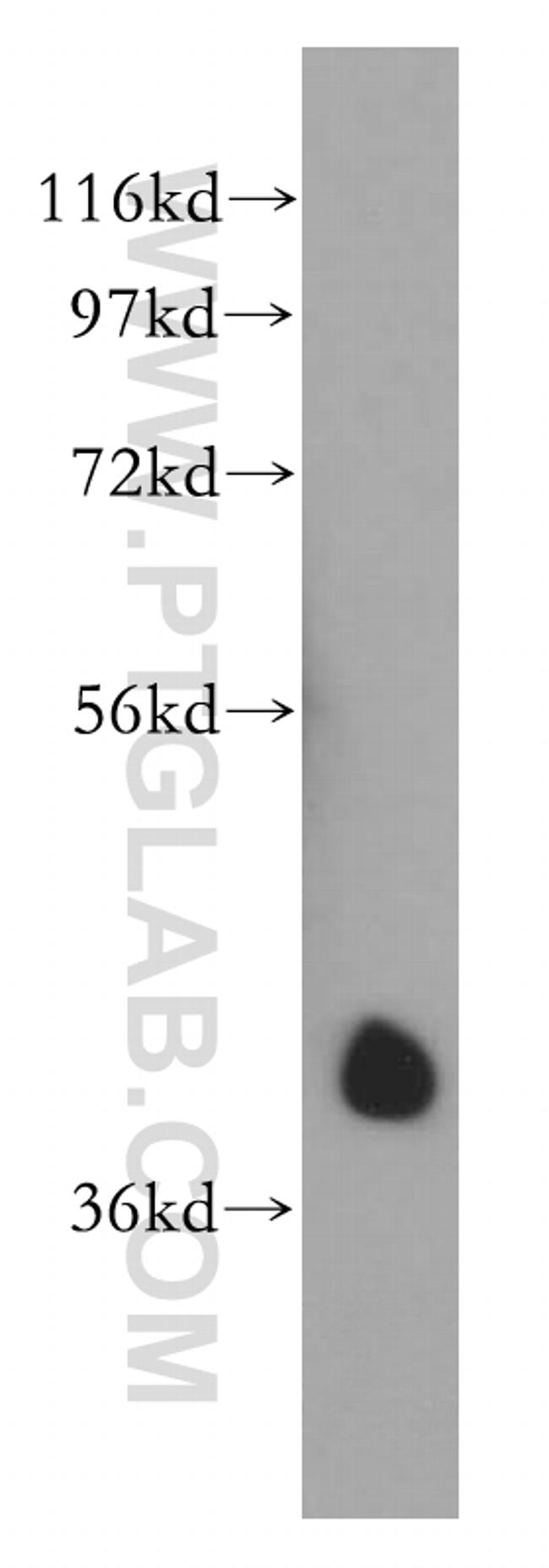 AUP1 Antibody in Western Blot (WB)