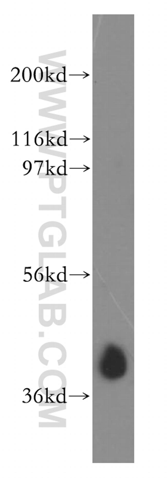 AUP1 Antibody in Western Blot (WB)