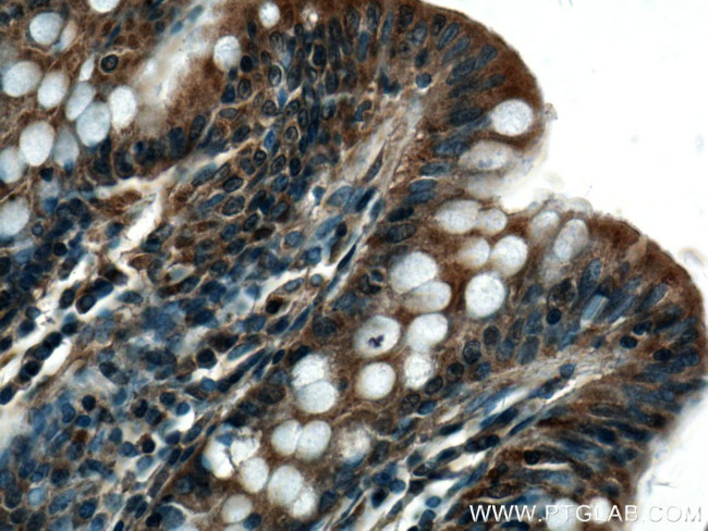 GRK3 Antibody in Immunohistochemistry (Paraffin) (IHC (P))