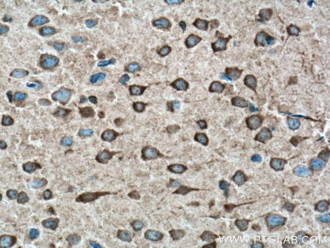 GRK3 Antibody in Immunohistochemistry (Paraffin) (IHC (P))