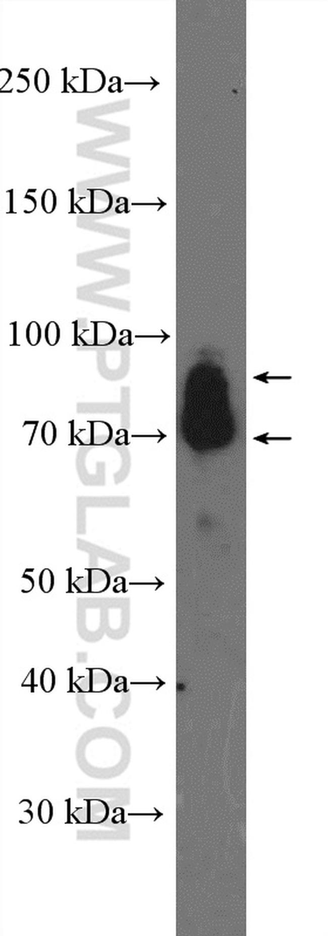 GRK3 Antibody in Western Blot (WB)