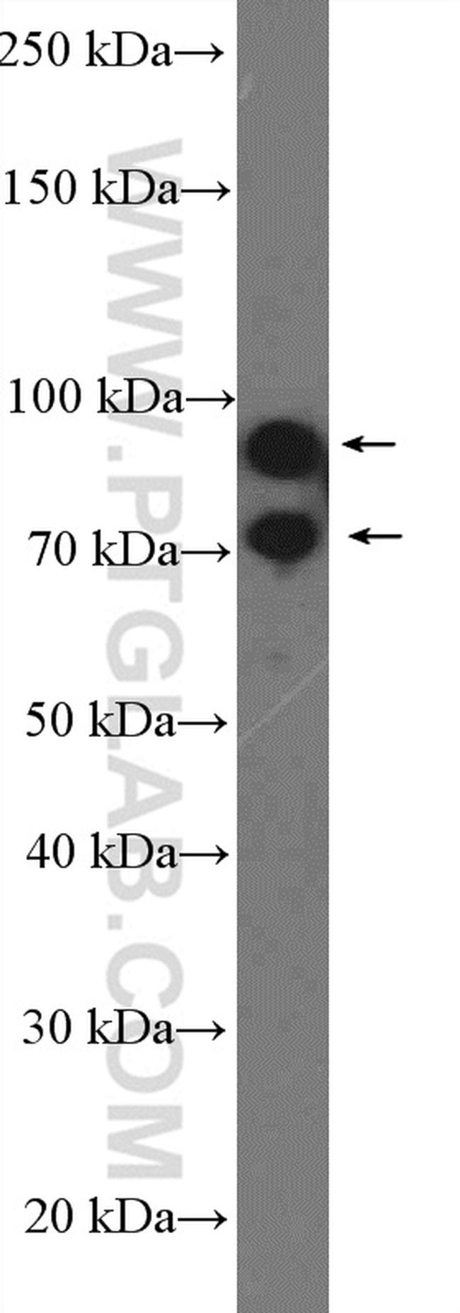 GRK3 Antibody in Western Blot (WB)