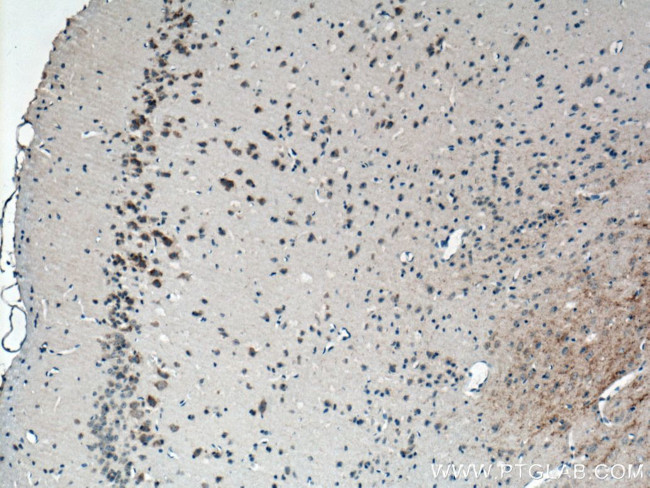 CACNG3 Antibody in Immunohistochemistry (Paraffin) (IHC (P))