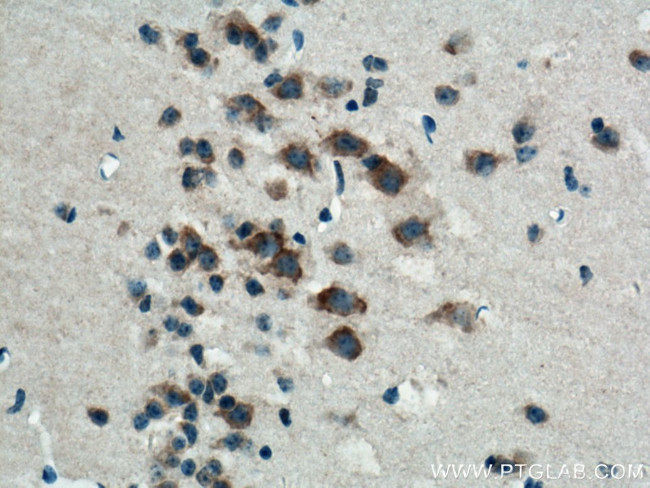 CACNG3 Antibody in Immunohistochemistry (Paraffin) (IHC (P))