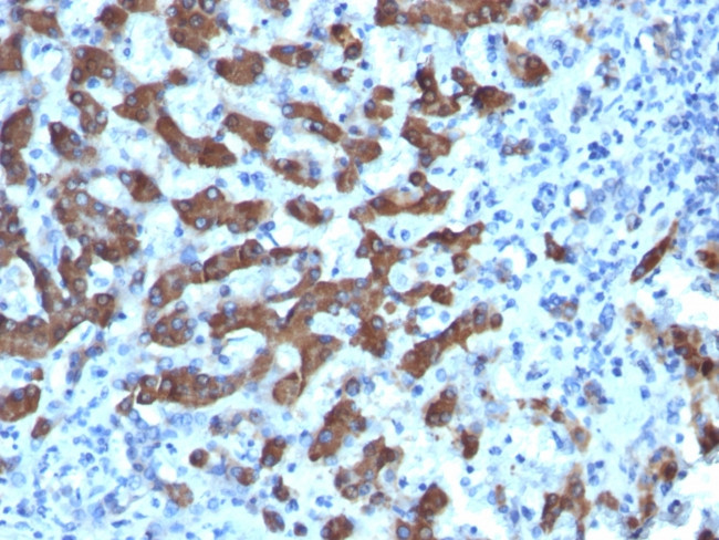 CPS1/Carbamoyl-Phosphate Synthetase Antibody in Immunohistochemistry (Paraffin) (IHC (P))