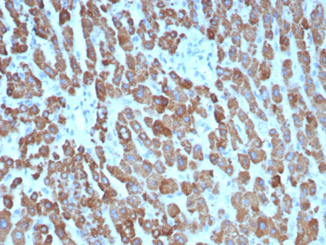 CPS1/Carbamoyl-Phosphate Synthetase (Hepatocellular Marker) Antibody in Immunohistochemistry (Paraffin) (IHC (P))