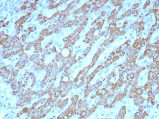 CPS1/Carbamoyl-Phosphate Synthetase (Hepatocellular Marker) Antibody in Immunohistochemistry (Paraffin) (IHC (P))