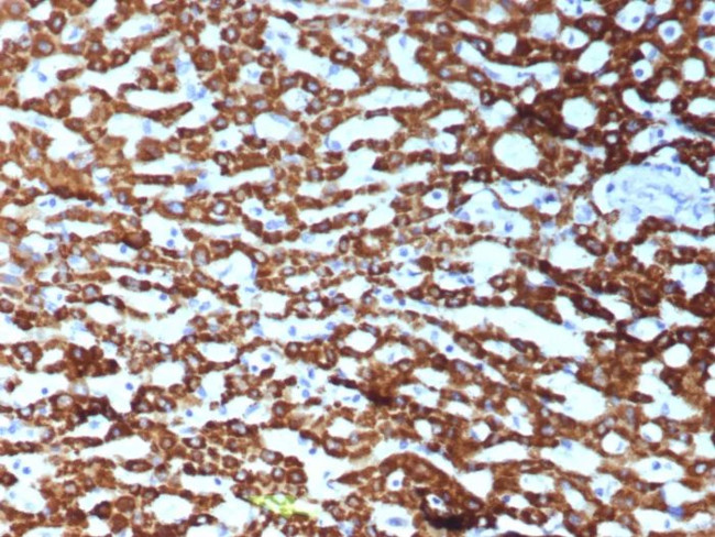 CPS1/Carbamoyl-Phosphate Synthetase (Hepatocellular Marker) Antibody in Immunohistochemistry (Paraffin) (IHC (P))