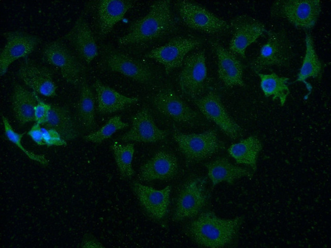 CAMK2 Antibody in Immunocytochemistry (ICC/IF)