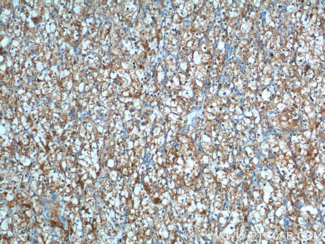 CAMK2 Antibody in Immunohistochemistry (Paraffin) (IHC (P))