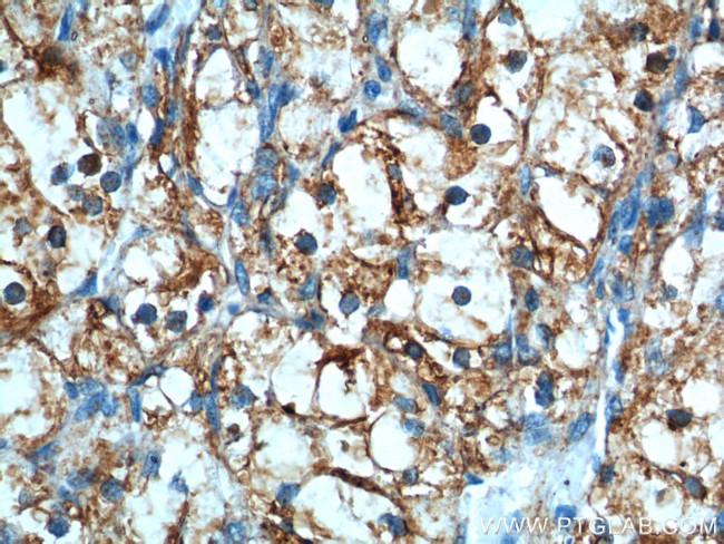 CAMK2 Antibody in Immunohistochemistry (Paraffin) (IHC (P))