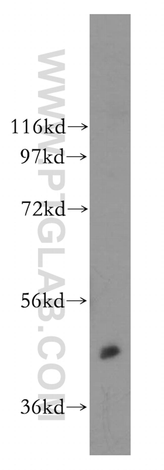 CAMK2 Antibody in Western Blot (WB)