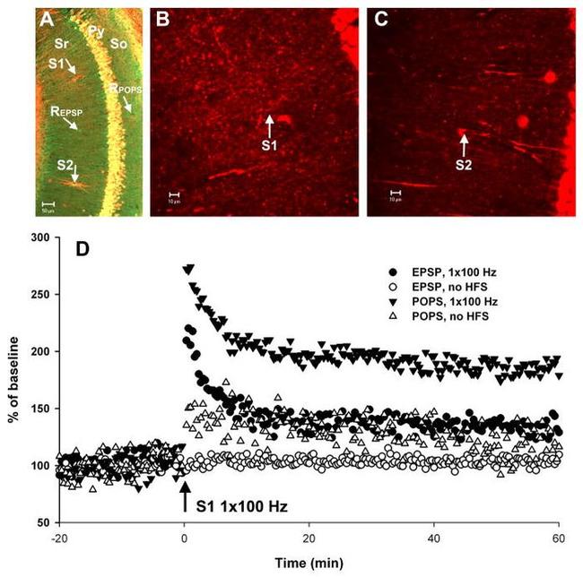 CaMKII alpha Antibody in Immunohistochemistry (IHC)