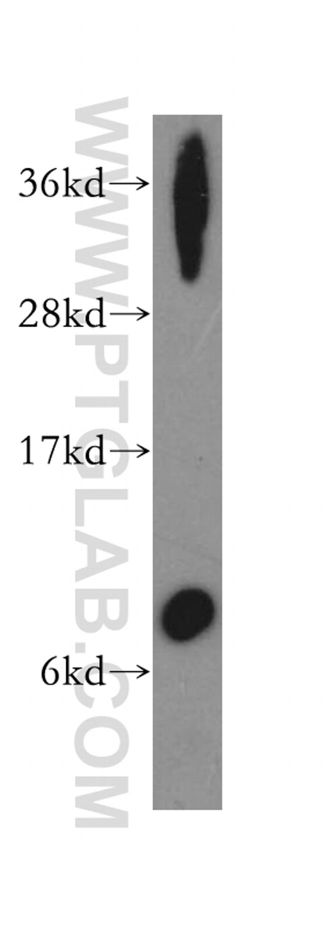 Trefoil factor 1 Antibody in Western Blot (WB)