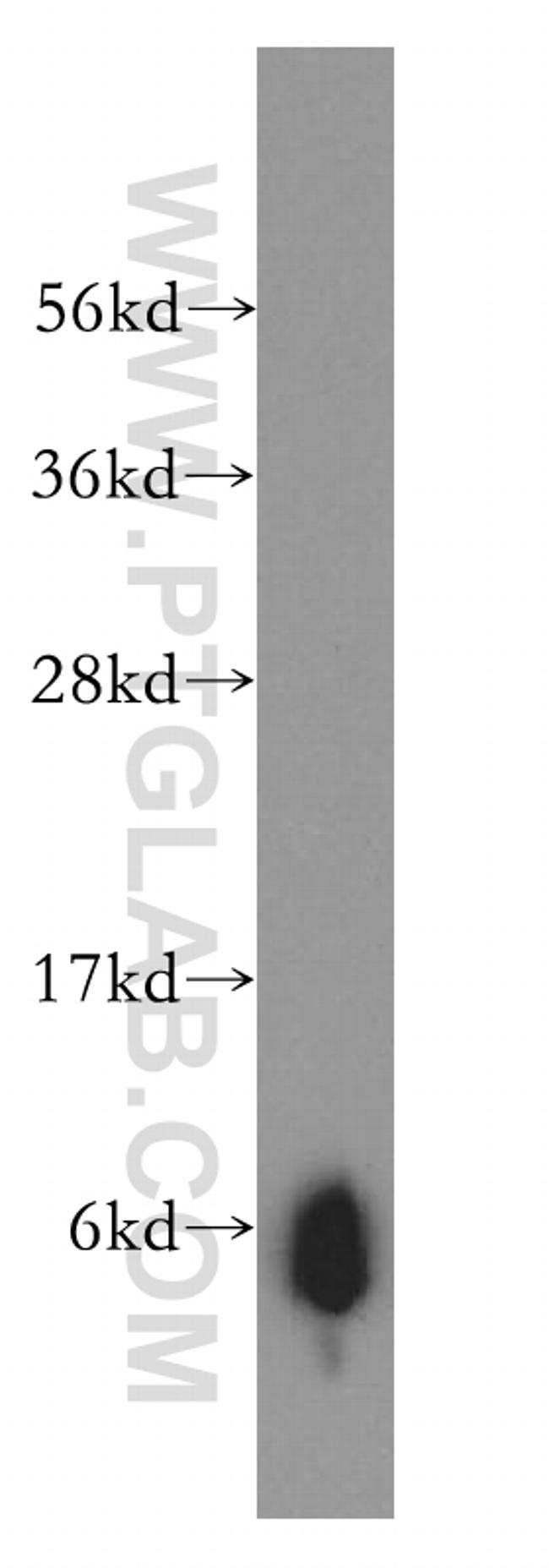 Trefoil factor 1 Antibody in Western Blot (WB)