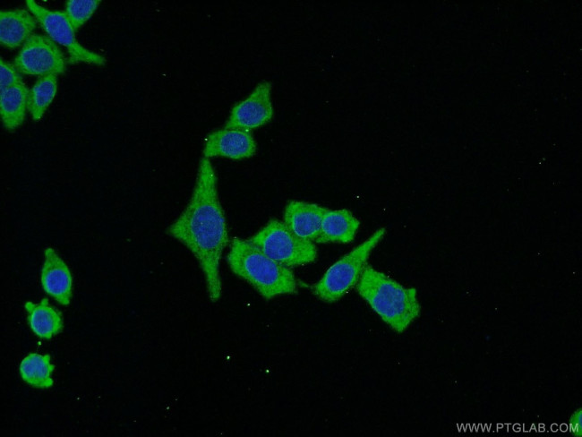 RACGAP1 Antibody in Immunocytochemistry (ICC/IF)