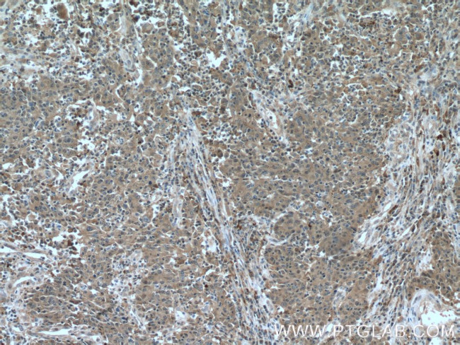 RACGAP1 Antibody in Immunohistochemistry (Paraffin) (IHC (P))