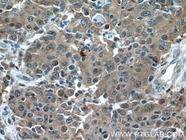 RACGAP1 Antibody in Immunohistochemistry (Paraffin) (IHC (P))