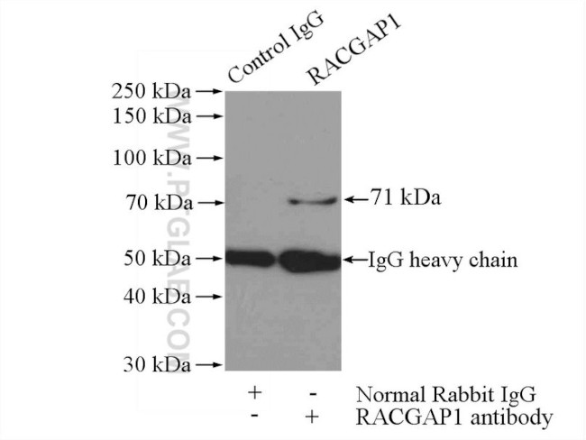 RACGAP1 Antibody in Immunoprecipitation (IP)