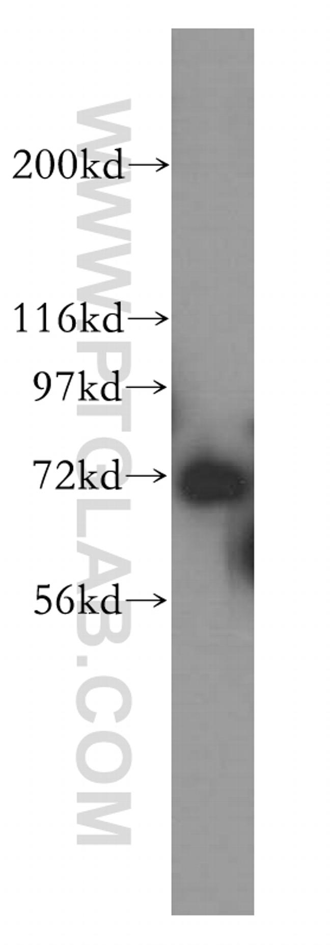 RACGAP1 Antibody in Western Blot (WB)