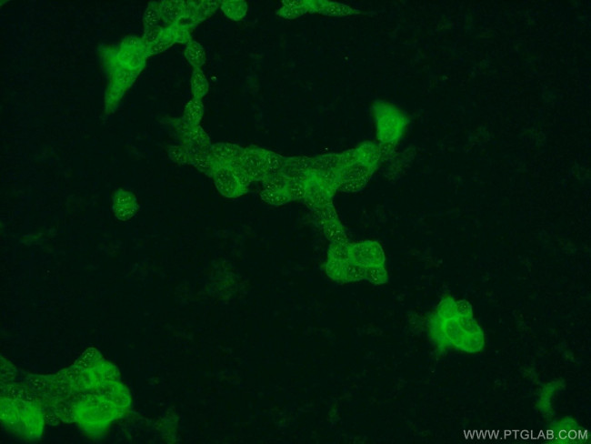 DUT Antibody in Immunocytochemistry (ICC/IF)