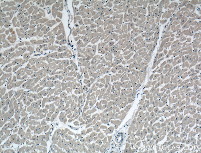 DUT Antibody in Immunohistochemistry (Paraffin) (IHC (P))