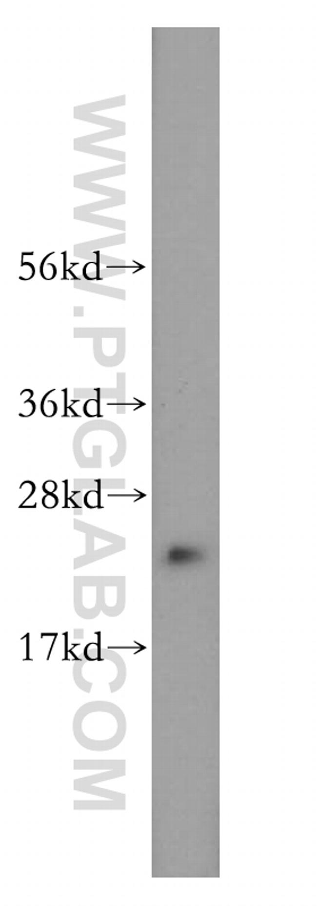 DUT Antibody in Western Blot (WB)