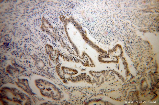 RNMT Antibody in Immunohistochemistry (Paraffin) (IHC (P))