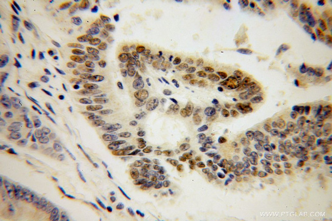 RNMT Antibody in Immunohistochemistry (Paraffin) (IHC (P))