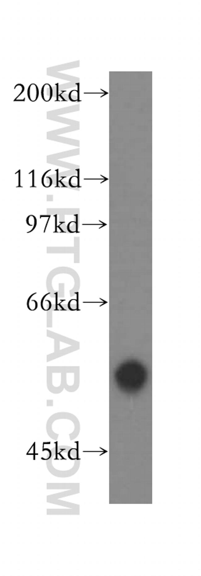RNMT Antibody in Western Blot (WB)