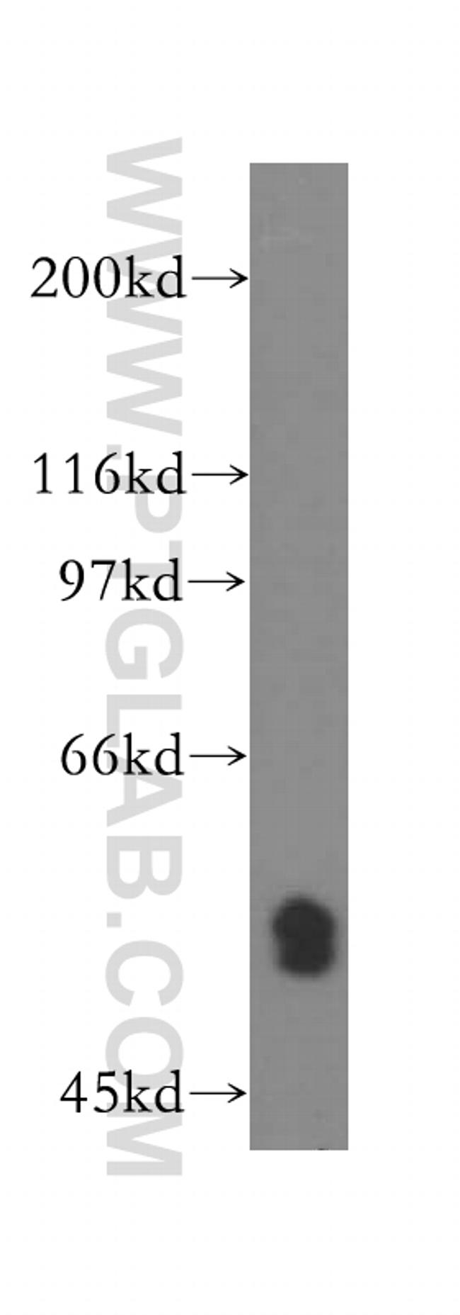 RNMT Antibody in Western Blot (WB)