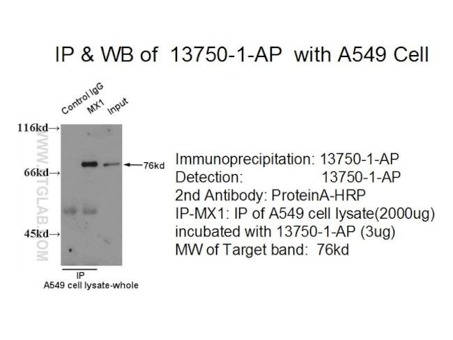 MX1 Antibody in Immunoprecipitation (IP)