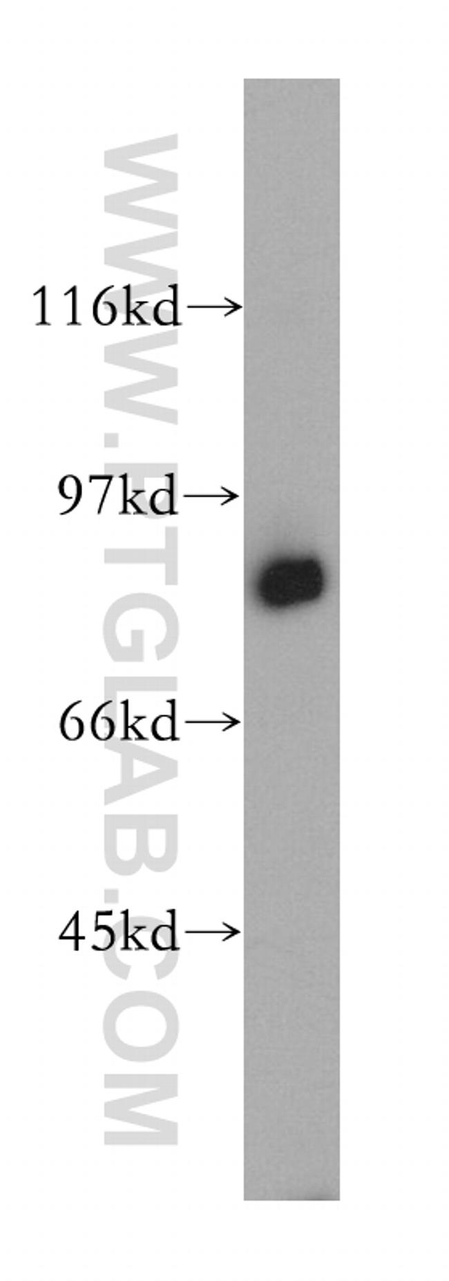 MX1 Antibody in Western Blot (WB)