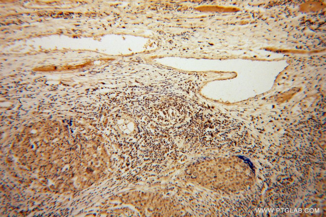 MYST2 Antibody in Immunohistochemistry (Paraffin) (IHC (P))