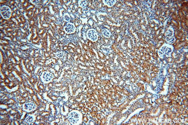 MYST2 Antibody in Immunohistochemistry (Paraffin) (IHC (P))