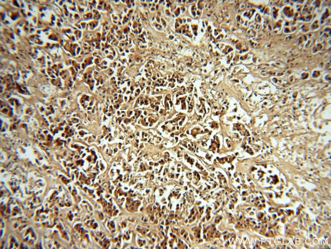 MYST2 Antibody in Immunohistochemistry (Paraffin) (IHC (P))